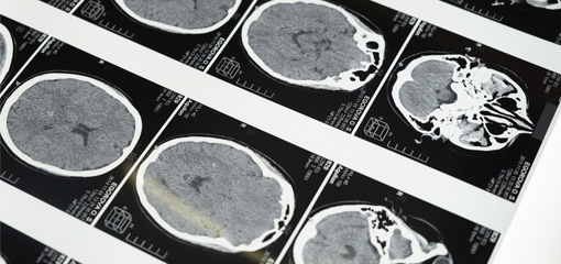 Diferencias entre el cerebro del hombre y el de la mujer